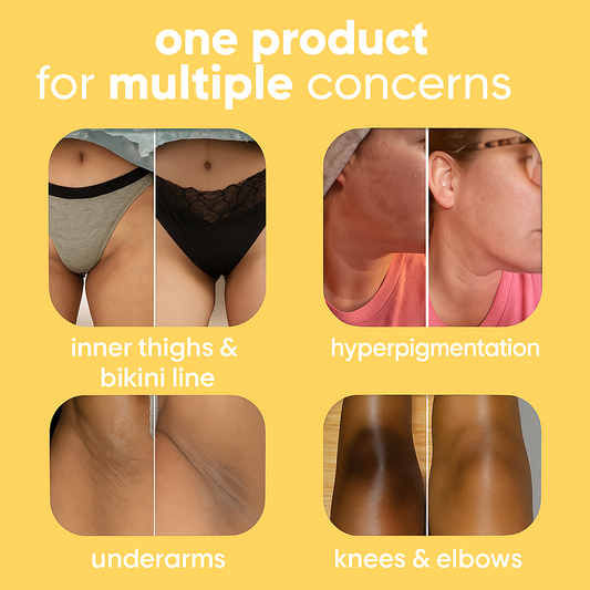 Why US Customers Are Choosing RareWagon Turmeric &amp; Kojic Acid Soap for Naturally Radiant Skin