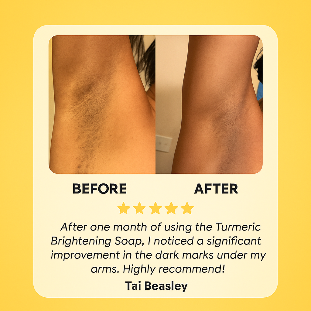 dyson hair dryer/shark hair dryer/dyson supersonic/dyson hairdryer /ghd hair dryer/ revlon hair dryer brush /shark hair styler /shark blow dryerhair dryer brush Rarewagon - Natural Turmeric & Kojic Acid Skin Brightening Soap